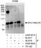 Kinesin-like protein KIFC1 antibody, A300-952A, Bethyl Labs, Immunoprecipitation image 