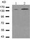 Structural Maintenance Of Chromosomes 1A antibody, TA321759, Origene, Western Blot image 