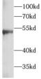 Tuj1 antibody, FNab09872, FineTest, Western Blot image 