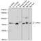Leucine Rich Repeat Containing 4 antibody, GTX64855, GeneTex, Western Blot image 