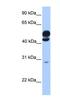 KLC2 antibody, NBP1-54771, Novus Biologicals, Western Blot image 