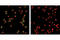 Zeta Chain Of T Cell Receptor Associated Protein Kinase 70 antibody, 2717T, Cell Signaling Technology, Immunofluorescence image 