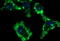 Cytochrome B-245 Chaperone 1 antibody, M31653, Boster Biological Technology, Immunofluorescence image 