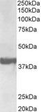 SH3 Domain Containing GRB2 Like 2, Endophilin A1 antibody, LS-B10349, Lifespan Biosciences, Western Blot image 