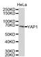 Yes Associated Protein 1 antibody, abx127115, Abbexa, Western Blot image 