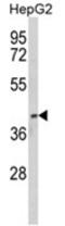 Paraoxonase 3 antibody, AP18154PU-N, Origene, Western Blot image 