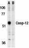 Caspase-12 antibody, PA1-30776, Invitrogen Antibodies, Western Blot image 