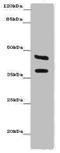 Carbonic Anhydrase 12 antibody, A55671-100, Epigentek, Western Blot image 