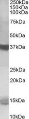 Prefoldin Subunit 1 antibody, LS-C55313, Lifespan Biosciences, Western Blot image 