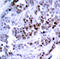BCL2 antibody, TA333169, Origene, Immunohistochemistry paraffin image 