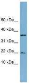 Dual specificity protein phosphatase 10 antibody, TA340368, Origene, Western Blot image 