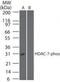 Histone Deacetylase 7 antibody, PA5-23203, Invitrogen Antibodies, Western Blot image 