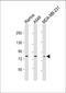 Toll Like Receptor 2 antibody, M00131-1, Boster Biological Technology, Western Blot image 