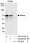IKAROS Family Zinc Finger 2 antibody, A303-619A, Bethyl Labs, Immunoprecipitation image 
