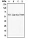 Abl Interactor 1 antibody, orb214949, Biorbyt, Western Blot image 