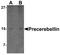 Cerebellin 1 Precursor antibody, A09176-3, Boster Biological Technology, Western Blot image 