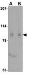 SLIT and NTRK-like protein 1 antibody, GTX31332, GeneTex, Western Blot image 