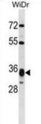 Hydroxymethylglutaryl-CoA lyase, mitochondrial antibody, abx028671, Abbexa, Western Blot image 
