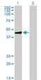 Melanoma-associated antigen 9 antibody, H00004108-B01P, Novus Biologicals, Western Blot image 
