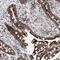 Electron Transfer Flavoprotein Subunit Alpha antibody, NBP1-84854, Novus Biologicals, Immunohistochemistry frozen image 