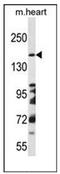 DCC Netrin 1 Receptor antibody, AP51195PU-N, Origene, Western Blot image 