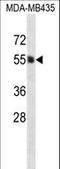 Phosphatidylinositol Glycan Anchor Biosynthesis Class A antibody, LS-C163711, Lifespan Biosciences, Western Blot image 