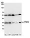 Peroxiredoxin-6 antibody, A305-316A, Bethyl Labs, Western Blot image 