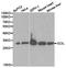 3,2-trans-enoyl-CoA isomerase, mitochondrial antibody, TA326999, Origene, Western Blot image 