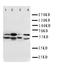 Serine Palmitoyltransferase Long Chain Base Subunit 1 antibody, LS-C312924, Lifespan Biosciences, Western Blot image 