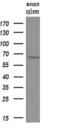 Guanylate Binding Protein 1 antibody, M03067, Boster Biological Technology, Western Blot image 