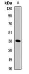 Dickkopf WNT Signaling Pathway Inhibitor 3 antibody, LS-C668895, Lifespan Biosciences, Western Blot image 