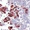 c-met antibody, MA5-16352, Invitrogen Antibodies, Immunohistochemistry frozen image 