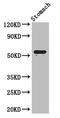 Ectonucleoside Triphosphate Diphosphohydrolase 8 antibody, A62482-100, Epigentek, Western Blot image 