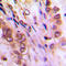 Aurora Kinase A antibody, LS-C354094, Lifespan Biosciences, Immunohistochemistry paraffin image 