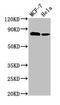 BCAR1 Scaffold Protein, Cas Family Member antibody, CSB-PA002593LA01HU, Cusabio, Western Blot image 