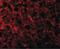 ANTXR Cell Adhesion Molecule 1 antibody, PA5-20016, Invitrogen Antibodies, Immunofluorescence image 