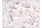 PCNA Clamp Associated Factor antibody, 81533S, Cell Signaling Technology, Immunohistochemistry paraffin image 