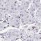 Rho guanine nucleotide exchange factor 5 antibody, HPA044188, Atlas Antibodies, Immunohistochemistry paraffin image 