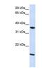 Claudin 16 antibody, NBP1-59105, Novus Biologicals, Western Blot image 
