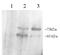 Proprotein Convertase Subtilisin/Kexin Type 9 antibody, ab28770, Abcam, Western Blot image 