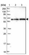 Coiled-Coil Domain Containing 125 antibody, NBP1-93660, Novus Biologicals, Western Blot image 