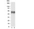 RUNX Family Transcription Factor 2 antibody, R30326, NSJ Bioreagents, Western Blot image 
