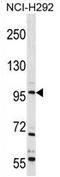 Transient Receptor Potential Cation Channel Subfamily C Member 4 antibody, AP54360PU-N, Origene, Western Blot image 