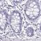 MORC Family CW-Type Zinc Finger 4 antibody, NBP1-82318, Novus Biologicals, Immunohistochemistry paraffin image 