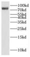 Family With Sequence Similarity 160 Member B2 antibody, FNab02971, FineTest, Western Blot image 
