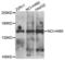 Collagen alpha-5(IV) chain antibody, LS-B15572, Lifespan Biosciences, Western Blot image 