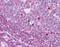 Aurora Kinase B antibody, GTX85607, GeneTex, Immunohistochemistry paraffin image 
