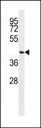 Microspherule Protein 1 antibody, PA5-48803, Invitrogen Antibodies, Western Blot image 