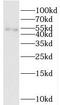 Chromosome 14 Open Reading Frame 39 antibody, FNab01026, FineTest, Western Blot image 