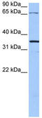 Neuroligin-4, X-linked antibody, TA338433, Origene, Western Blot image 